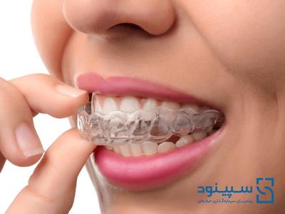 امکانسنجی و طرح توجیهی طرح تولید پلاک شفاف دندانی (نامرئی)